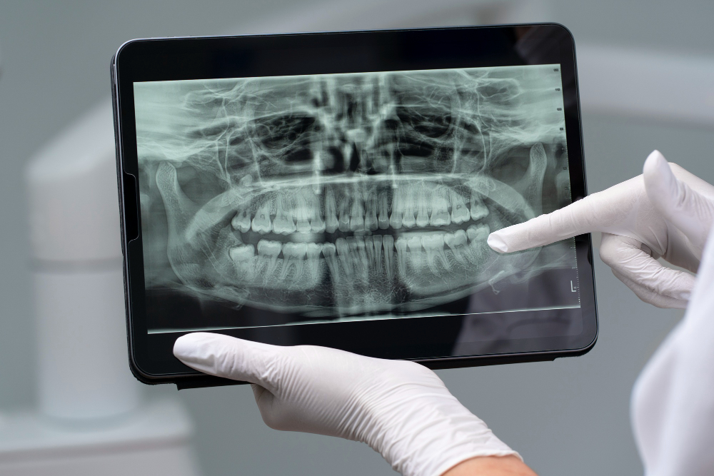 Digital X-Rays Godfrey, IL