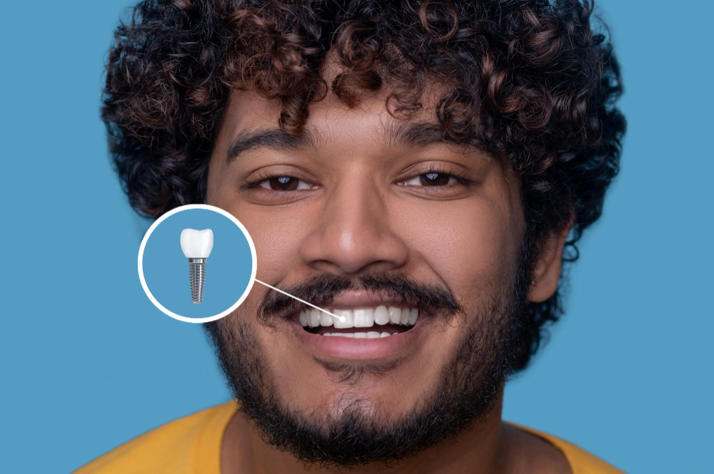 Implant Restoration in Godfrey