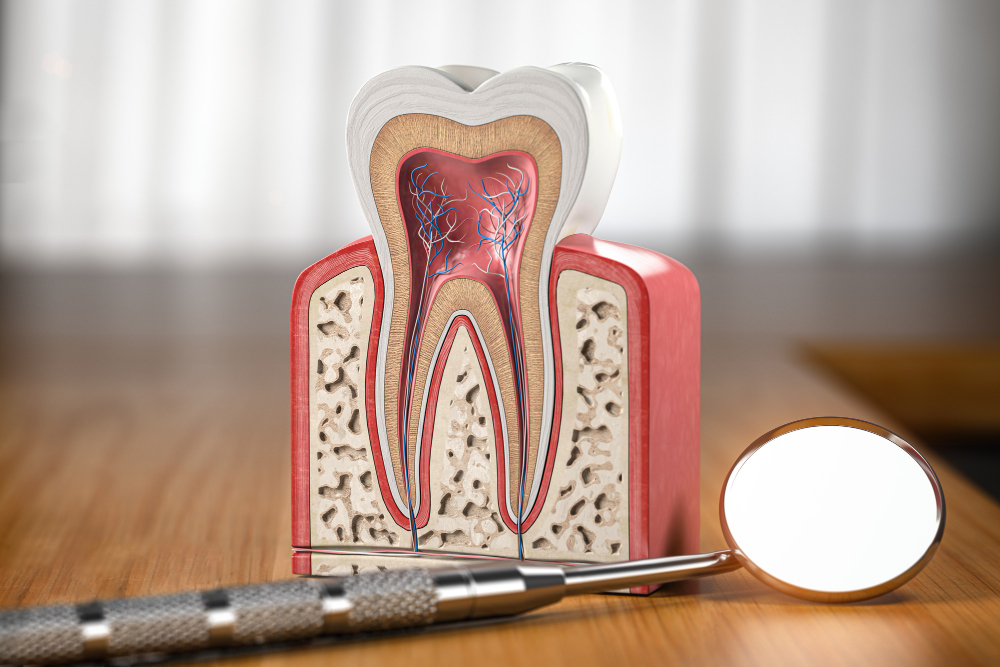 Root Canals  Godfrey, IL
