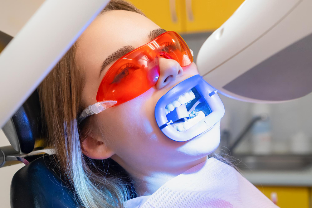 Teeth Whitening Godfrey, IL